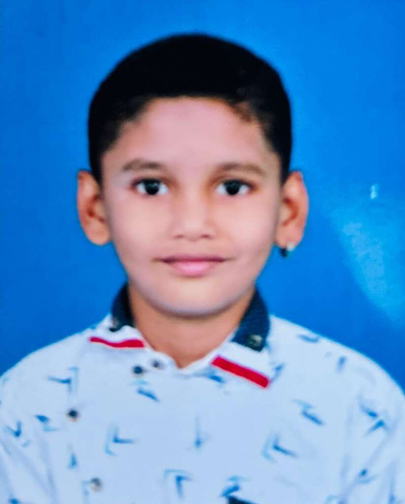 पाचगाव उपनगरात पिसाळलेल्या कुत्र्याने लहान मुलांचा घेतला चावा